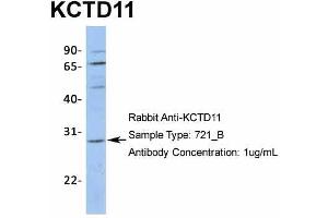 Host:  Rabbit  Target Name:  KCTD11  Sample Type:  721_B  Antibody Dilution:  1. (KCTD11 抗体  (N-Term))