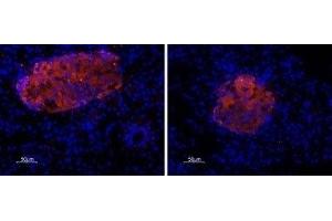 Immunohistochemistry (IHC) image for anti-Purinergic Receptor P2X, Ligand-Gated Ion Channel, 7 (P2RX7) (AA 576-595), (Intracellular) antibody (ABIN7043576)