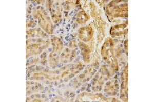 Immunohistochemistry of paraffin-embedded mouse kidney using ACADM antibody at dilution of 1:200 (x400 lens) (Medium-Chain Specific Acyl-CoA Dehydrogenase, Mitochondrial (AA 1-220) 抗体)