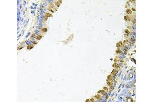 Immunohistochemistry of paraffin-embedded Mouse lung using KLK11 Polyclonal Antibody at dilution of 1:100 (40x lens). (Kallikrein 11 抗体)