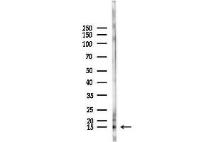 anti-Pleckstrin Homology-Like Domain, Family A, Member 3 (PHLDA3) (C-Term) antibody