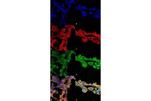 Immunocytochemistry/Immunofluorescence analysis using Mouse Anti-7-Ketocholesterol Monoclonal Antibody, Clone 7E1 . (7-Ketocholesterol (7-KC) 抗体 (Biotin))