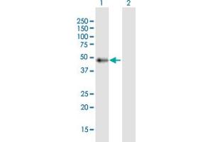 Western Blot analysis of C9orf72 expression in transfected 293T cell line by C9orf72 MaxPab polyclonal antibody. (C9ORF72 抗体  (AA 1-481))