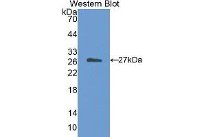Western blot analysis of the recombinant protein. (CETP 抗体  (AA 81-311))