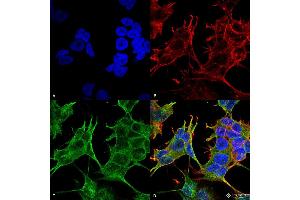 Immunocytochemistry/Immunofluorescence analysis using Mouse Anti-GluN2A/NR2A Monoclonal Antibody, Clone S327-95 .
