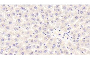 Detection of NOX3 in Rat Liver Tissue using Polyclonal Antibody to Nicotinamide Adenine Dinucleotide Phosphate Oxidase 3 (NOX3) (NOX3 抗体  (AA 221-466))