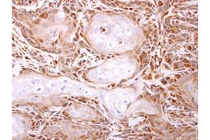 IHC-P Image ITPase antibody [N1C3] detects ITPase protein at cytosol on Ca922 xenograft by immunohistochemical analysis. (ITPA 抗体)