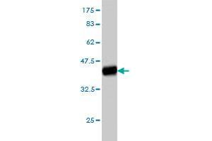 Western Blot detection against Immunogen (37. (ITGA4 抗体  (AA 98-207))