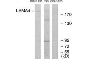Western blot analysis of extracts from COLO/293 cells, using LAMA4 Antibody. (LAMa4 抗体  (AA 481-530))