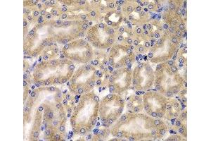 Immunohistochemistry of paraffin-embedded Mouse kidney using CARD10 Polyclonal Antibody at dilution of 1:100 (40x lens). (CARD10 抗体)