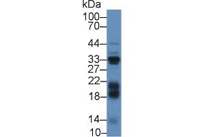 Detection of IGFBP3 in Mouse Liver lysate using Polyclonal Antibody to Insulin Like Growth Factor Binding Protein 3 (IGFBP3) (IGFBP3 抗体  (AA 106-241))