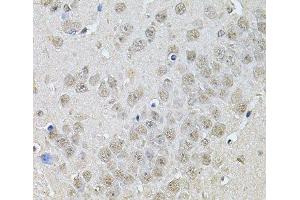 Immunohistochemistry of paraffin-embedded Mouse brain using DR1 Polyclonal Antibody at dilution of 1:100 (40x lens). (DR1 抗体)