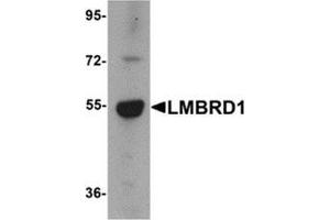 Western blot analysis of LMBRD1 in human brain tissue lysate with LMBRD1 antibody at 1 μg/ml.