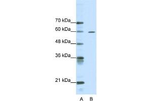 WB Suggested Anti-ARID3A Antibody Titration:  0. (ARID3A 抗体  (Middle Region))