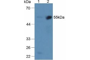 Western blot analysis of (1) Mouse Liver Tissue and (2) Mouse Kidney Tissue. (alpha 2 Antiplasmin 抗体  (AA 340-491))