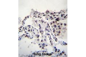 MEIG1 Antibody (Center) immunohistochemistry analysis in formalin fixed and paraffin embedded human lung tissue followed by peroxidase conjugation of the secondary antibody and DAB staining. (MEIG1 抗体  (Middle Region))
