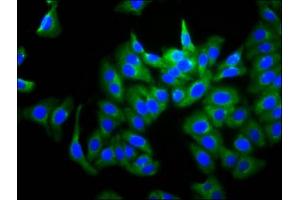 Immunofluorescence staining of HepG2 cells with ABIN7167772 at 1:266, counter-stained with DAPI. (GUCY2D 抗体  (AA 362-462))