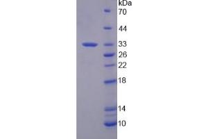 SDS-PAGE analysis of Human SF3B1 Protein. (SF3B1 蛋白)