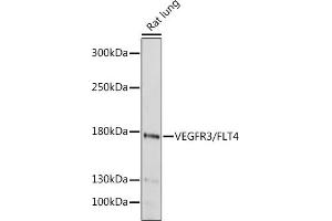 Western blot analysis of extracts of Rat lung, using VEGFR3/FLT4 antibody (ABIN6130779, ABIN6140698, ABIN6140701 and ABIN6217251) at 1:1000 dilution. (FLT4 抗体  (AA 1174-1363))