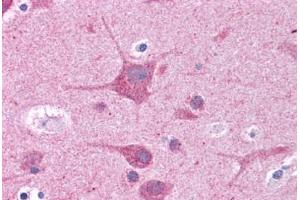 Human Brain, Cortex: Formalin-Fixed, Paraffin-Embedded (FFPE) (RORC 抗体  (AA 110-159))