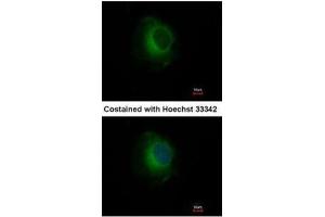 ICC/IF Image Immunofluorescence analysis of methanol-fixed HeLa, using Plasminogen, antibody at 1:500 dilution. (PLG 抗体)