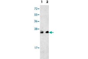 Western blot analysis of multiple cells cell lysate (35 ug/lane) with PTP4A3 polyclonal antibody . (PTP4A3 抗体  (C-Term))