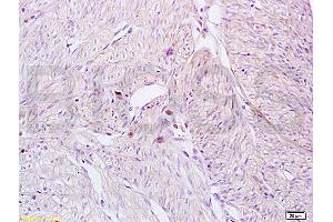 Immunohistochemistry (IHC) image for anti-Killer Cell Lectin-Like Receptor Subfamily B, Member 1 (KLRB1) (AA 151-225) antibody (ABIN680998)