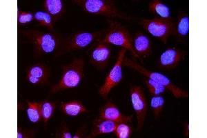 IF analysis of Alpha B Crystallin/CRYAB using anti-Alpha B Crystallin/CRYAB antibody (ABIN7601209).