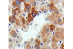 IHC-P analysis of Liver tissue, with DAB staining. (FGL1 抗体  (AA 23-314))