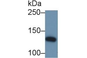 Detection of IRS1 in Bovine Cerebrum lysate using Polyclonal Antibody to Insulin Receptor Substrate 1 (IRS1) (IRS1 抗体  (AA 837-1089))