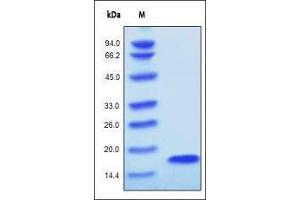 Human FGF acidic, Tag Free on SDS-PAGE under reducing (R) condition. (FGF acidic (AA 16-155) 蛋白)
