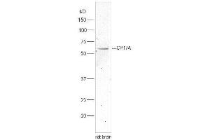 Lane 1:rat brain lysates probed with Rabbit Anti-Cytochrome P450 17A1 Polyclonal Antibody, Unconjugated  at 1:5000 for 90 min at 37˚C. (CYP17A1 抗体  (AA 24-65))