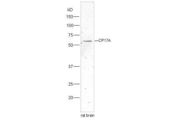 CYP17A1 抗体  (AA 24-65)
