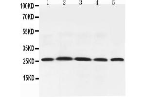 Western Blotting (WB) image for anti-Adiponectin (ADIPOQ) (AA 19-244) antibody (ABIN3042521)