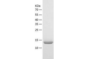 Western Blotting (WB) image for Thioredoxin-Like 4B (TXNL4B) (AA 1-149) protein (His tag) (ABIN7125367) (TXNL4B Protein (AA 1-149) (His tag))