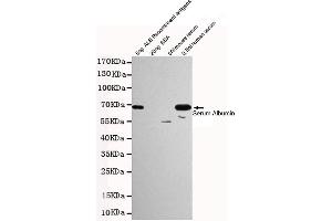 Western blot detection of Human Serum Albumin in 0. (HSA 抗体)