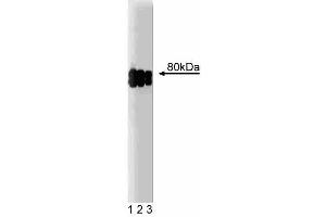 Western blot analysis of CLA-1 on a HeLa cell lysate (Human cervical epitheloid carcinoma, ATCC CCL-2. (SCARB1 抗体  (AA 104-294))