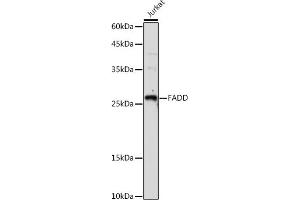 Western blot analysis of extracts of Jurkat cells, using FADD antibody (ABIN7267137) at 1:1000 dilution. (FADD 抗体)