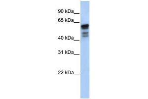 WB Suggested Anti-DES Antibody Titration:  0. (Desmin 抗体  (Middle Region))
