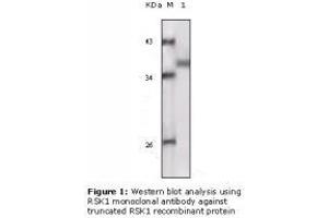 Image no. 2 for anti-Ribosomal Protein S6 Kinase, 90kDa, Polypeptide 1 (RPS6KA1) antibody (ABIN207641) (RPS6KA1 抗体)