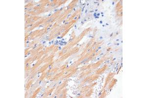 Immunohistochemistry of paraffin-embedded rat heart using PDCD2L antibody (ABIN6130653, ABIN6145336, ABIN6145337 and ABIN6223261) at dilution of 1:100 (40x lens). (PDCD2L 抗体  (AA 1-358))