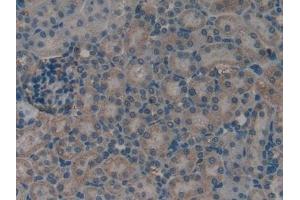 Detection of S100A11 in Rat Kidney Tissue using Polyclonal Antibody to S100 Calcium Binding Protein A11 (S100A11) (S100A11 抗体  (AA 9-98))