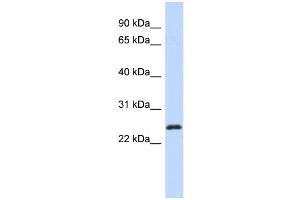 WB Suggested Anti-KLF16 Antibody Titration: 0. (KLF16 抗体  (Middle Region))