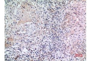 Immunohistochemistry (IHC) analysis of paraffin-embedded Human Lung, antibody was diluted at 1:100. (MCM7 抗体  (Internal Region))