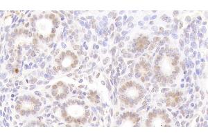 Immunohistochemistry (IHC) image for anti-Nucleoporin 88kDa (NUP88) (AA 57-296) antibody (ABIN7441823)