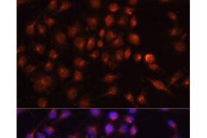 Immunofluorescence analysis of HeLa cells using RAB11A Polyclonal Antibody at dilution of 1:100. (RAB11A 抗体)