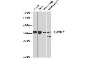 Western blot analysis of extracts of various cell lines, using L2 antibody (ABIN6129912, ABIN6136940, ABIN6136941 and ABIN6223557) at 1:1000 dilution. (ANXA8L2 抗体  (AA 1-276))