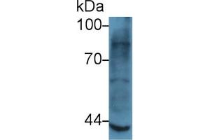 Western Blot; Sample: Rat Skeletal muscle lysate; Primary Ab: 5µg/ml Rabbit Anti-Human MMP3 Antibody Second Ab: 0. (MMP3 抗体  (AA 363-477))