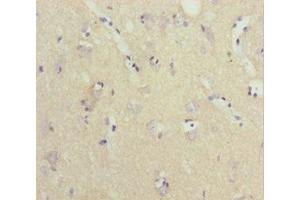 Immunohistochemistry of paraffin-embedded human brain tissue using ABIN7161439 at dilution of 1:100 (NPTN 抗体  (AA 29-200))