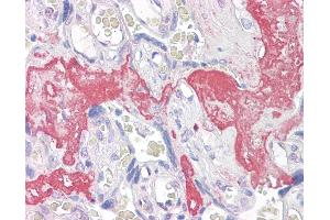 Anti-GAGED2 antibody IHC of human placenta. (XAGE1D 抗体  (AA 58-69))